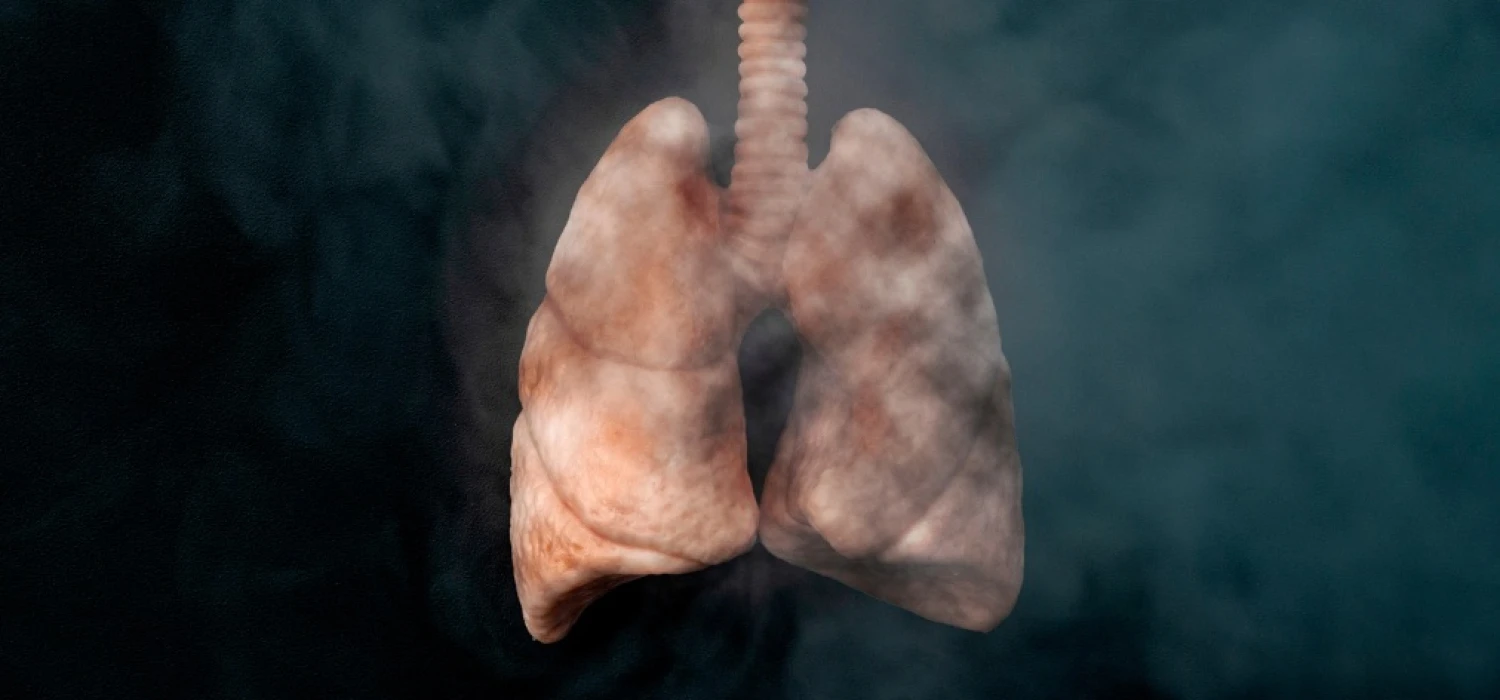 Choroby płuc – skutki palenia papierosów - zdjęcie