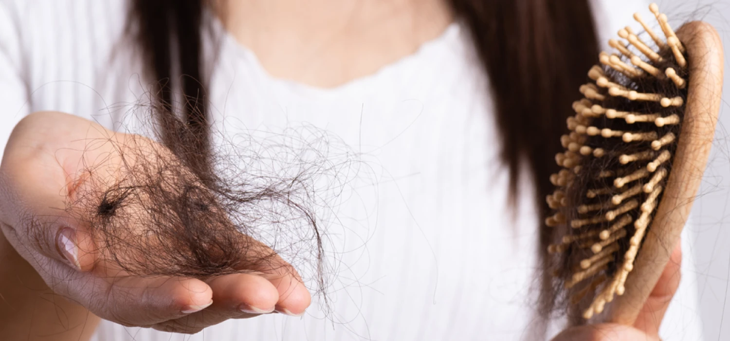 Wypadanie włosów – przyczyny, diagnoza, skuteczne metody leczenia