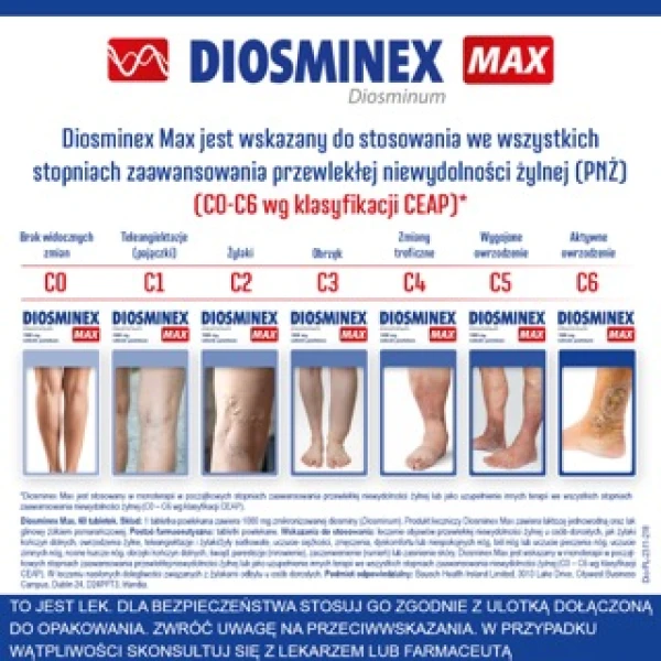 diosminex-max-1000-mg-60-tabletek