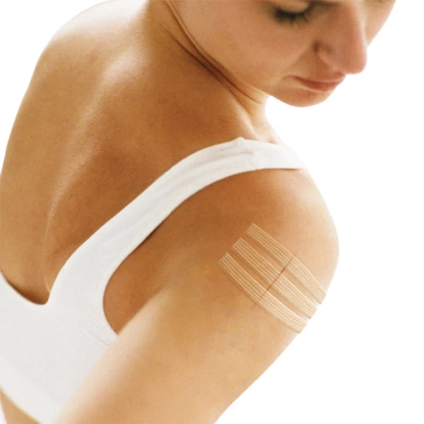 viscoplast-steri-strip-paski-do-zamykania-ran-8-sztuk