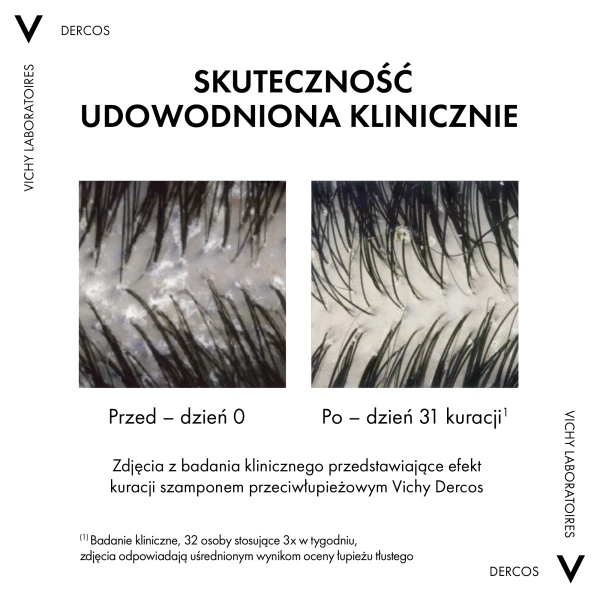 vichy-dercos-anti-dandruff-ds-szampon-przeciwlupiezowy-wlosy-normalne-i-przetluszczajace-sie-390-ml