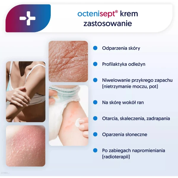 octenisept-protect-repair-krem-do-podraznionej-50-ml