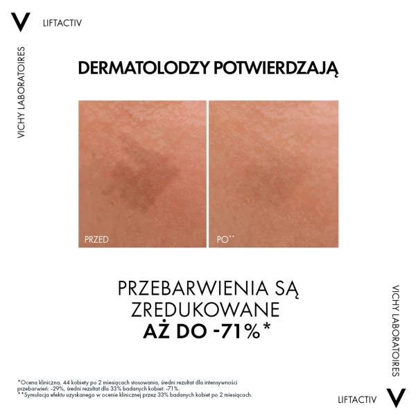 vichy-liftactiv-specialist-b3-serum-redukujace-przebarwienia-i-zmarszczki-30-ml