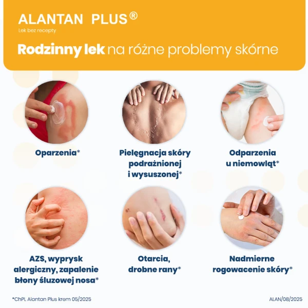 alantan-plus-krem-35-g