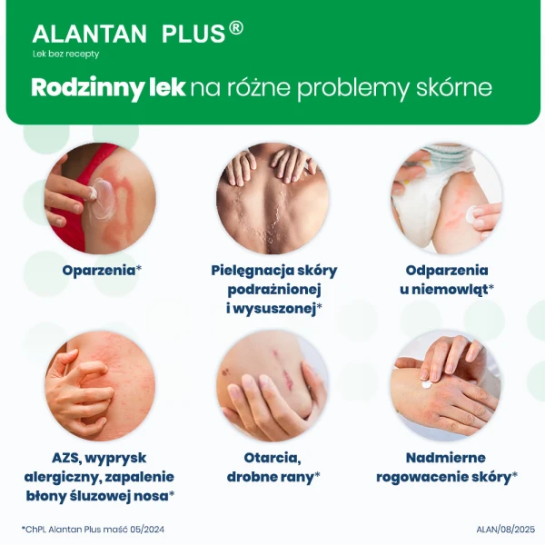 alantan-plus-masc-30-g