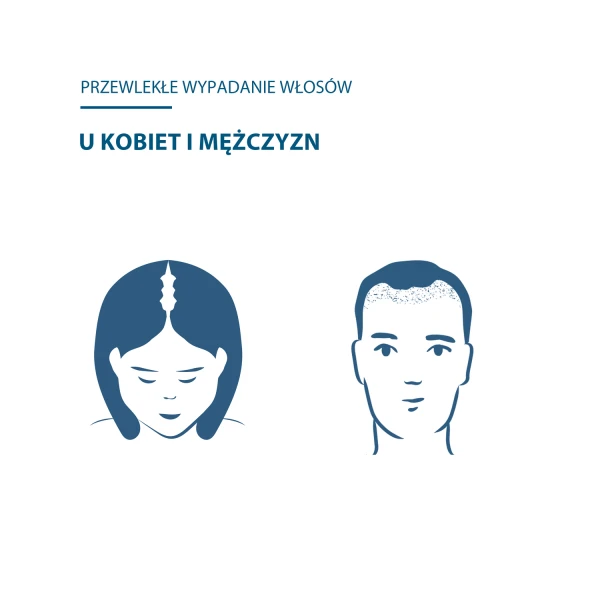 Durcay Neoptide Expert, serum zapobiegające wypadaniu włosów i wspomagajace porost, 2 x 50 ml