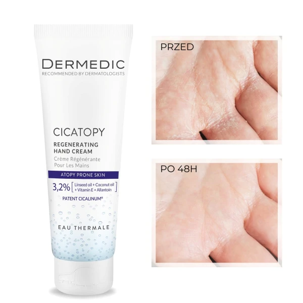 Dermedic Cicatopy, regenerujący krem do rąk, 75 ml