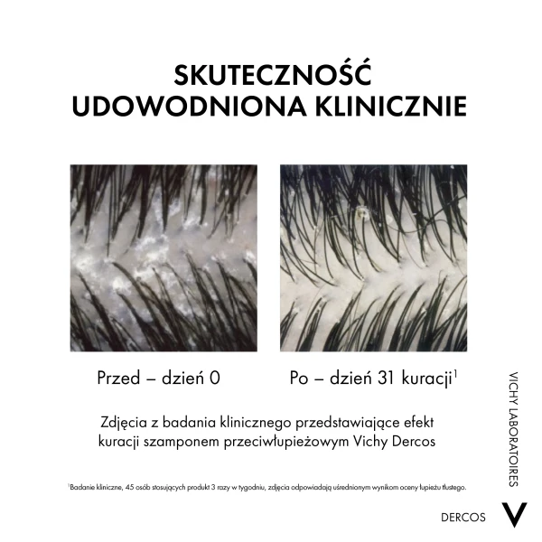 Vichy Dercos Anti Dandruff DS, szampon przeciwłupieżowy z odżywką 2w1, 200 ml