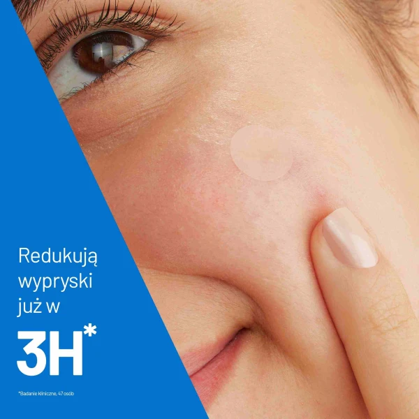 CeraVe Punktowe plasterki na wypryski, 22 sztuki