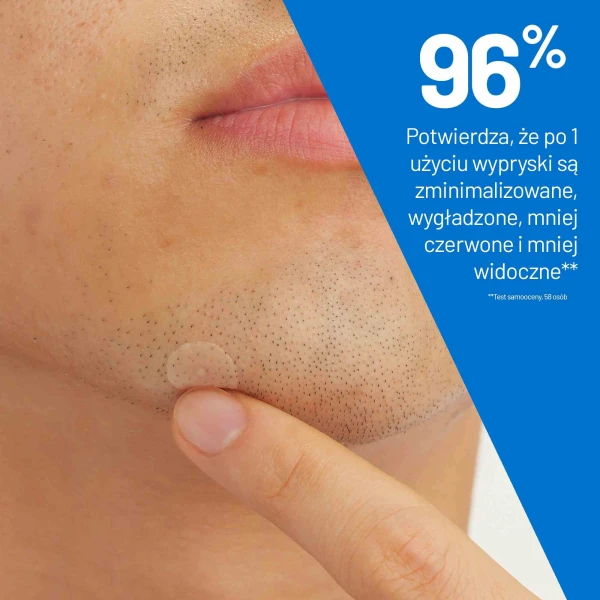 CeraVe Punktowe plasterki na wypryski, 22 sztuki