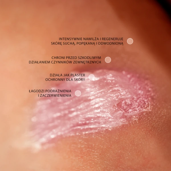 Swederm Hudsalva, maść silnie natłuszczająca z witaminą E, skóra sucha, 50 ml