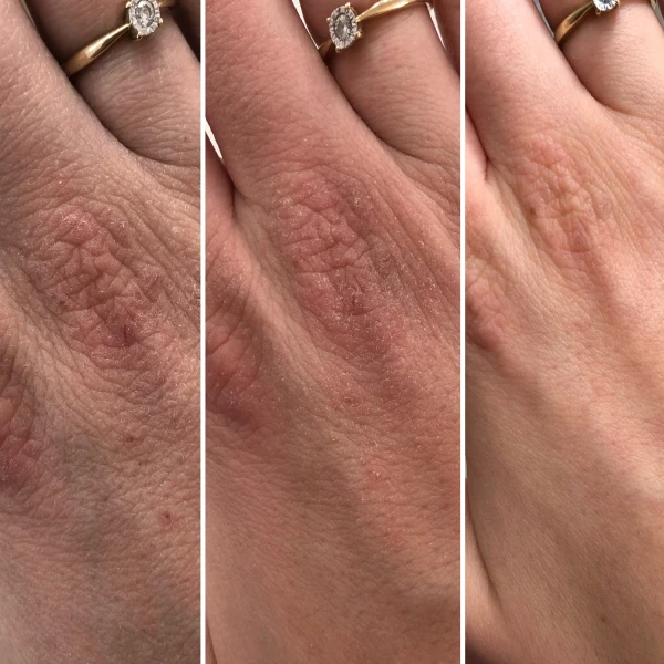 Swederm Hudsalva Sensitive, maść silnie natłuszczająca, skóra sucha, 50 ml